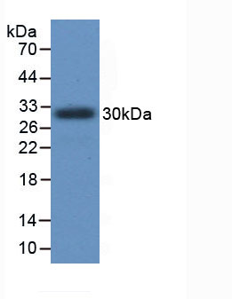 Figure . Western Blot