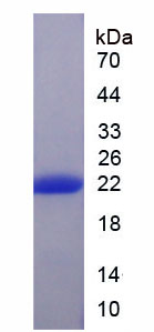 Figure . SDS-PAGE