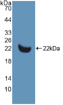 Figure . Western Blot