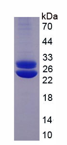 Figure . SDS-PAGE