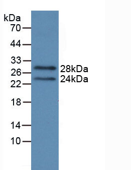 Figure . Western Blot
