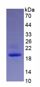 Figure . SDS-PAGE