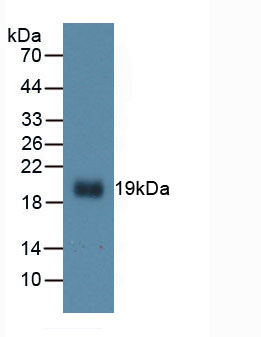 Figure . Western Blot