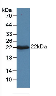 Figure . Western Blot