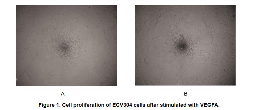 Figure 1.Cell proliferation of ECV304 cells after stimulated with VEGFA.