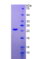 Figure . SDS-PAGE