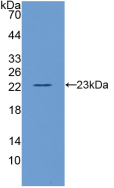 Figure . Western Blot