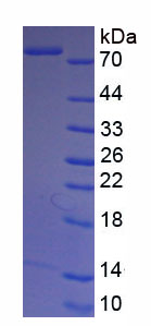 Figure. SDS-PAGE