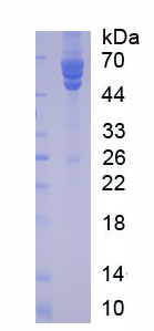 Figure. SDS-PAGE