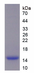 Figure . SDS-PAGE