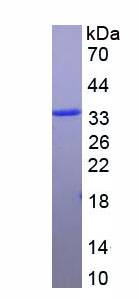 Figure . SDS-PAGE