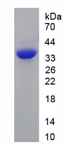 Figure . SDS-PAGE