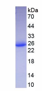 Figure . SDS-PAGE