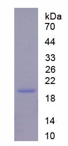 Figure . SDS-PAGE