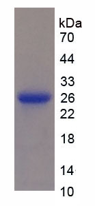 Figure . SDS-PAGE