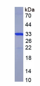 Figure . SDS-PAGE