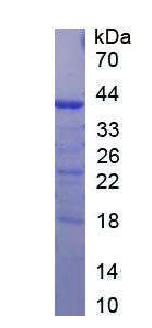 Figure. SDS-PAGE