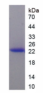 Figure . SDS-PAGE