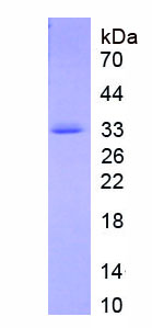 Figure . SDS-PAGE
