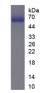 Figure . SDS-PAGE