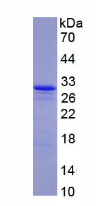 Figure . SDS-PAGE