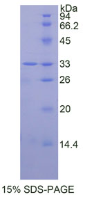 Figure . SDS-PAGE