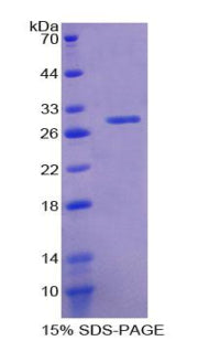Figure . SDS-PAGE