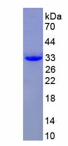 Figure . SDS-PAGE