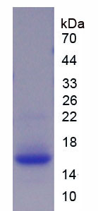 Figure . SDS-PAGE