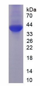 Figure . SDS-PAGE