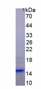 Figure . SDS-PAGE