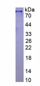 Figure . SDS-PAGE