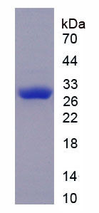 Figure . SDS-PAGE