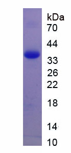 Figure . SDS-PAGE