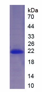 Figure . SDS-PAGE