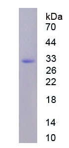 Figure . SDS-PAGE