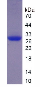 Figure . SDS-PAGE
