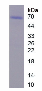 Figure . SDS-PAGE