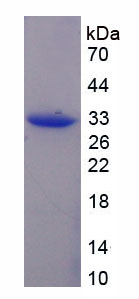 Figure . SDS-PAGE