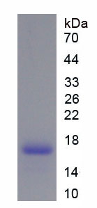 Figure . SDS-PAGE
