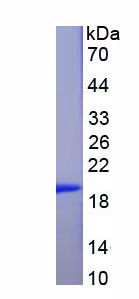 Figure . SDS-PAGE
