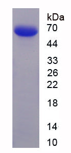 Figure . SDS-PAGE