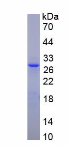 Figure . SDS-PAGE