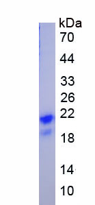 Figure. SDS-PAGE