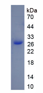 Figure . SDS-PAGE