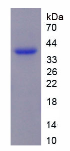 Figure . SDS-PAGE