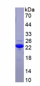 Figure . SDS-PAGE