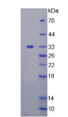 Figure . SDS-PAGE