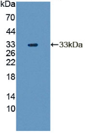 Figure . Western Blot