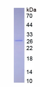 Figure . SDS-PAGE